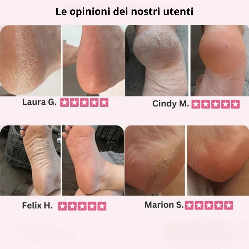 DermaGlide Pro con 60 cuscinetti scorrevoli (gratuiti)