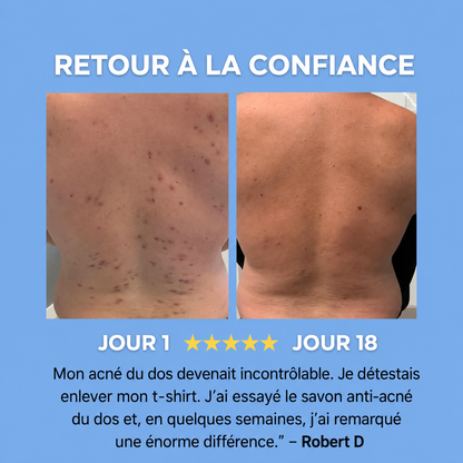 Savon anti-acné du dos