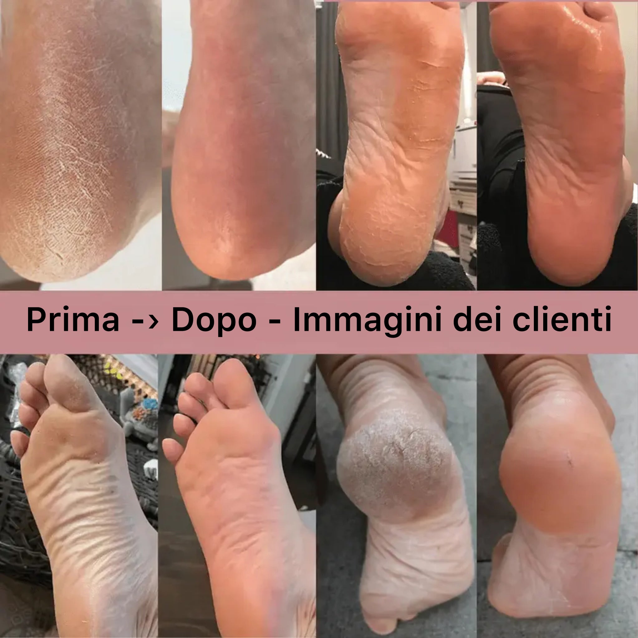 DermaGlide Pro con 60 cuscinetti scorrevoli (gratuiti)